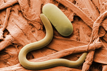 Photo: Soybean cyst nematode and egg. Link to high-resolution image.
