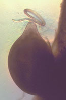 Soybean cyst nematode male and female